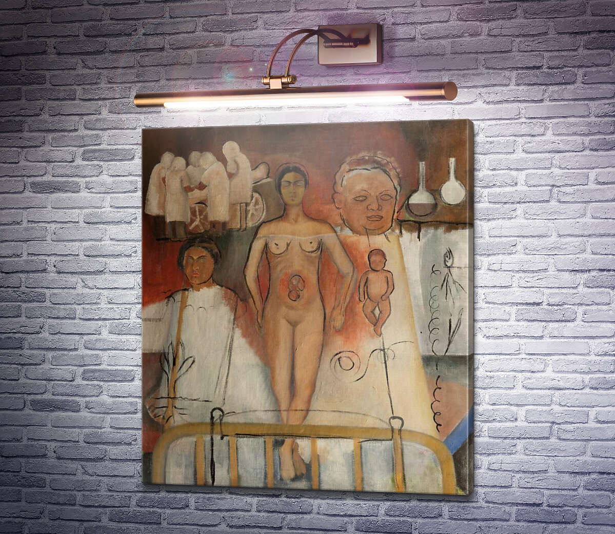 Картина Фріда і кесарів розтин Фріда Кало