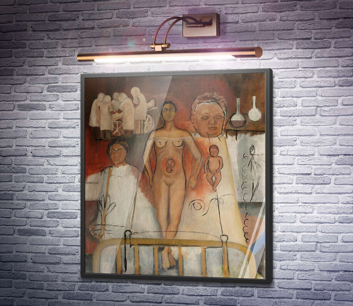 Постер Фріда і кесарів розтин Фріда Кало